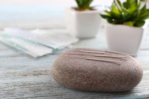 acupuncture needles and massage stone
